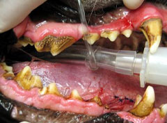 Зубной камень образуется только на эмали зубов